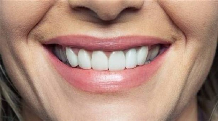بينها التنظيف على عجل.. لا تتلف أسنانك بهذه الأخطاء البسيطة
